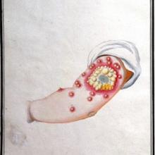 Thumbnail of medical drawing